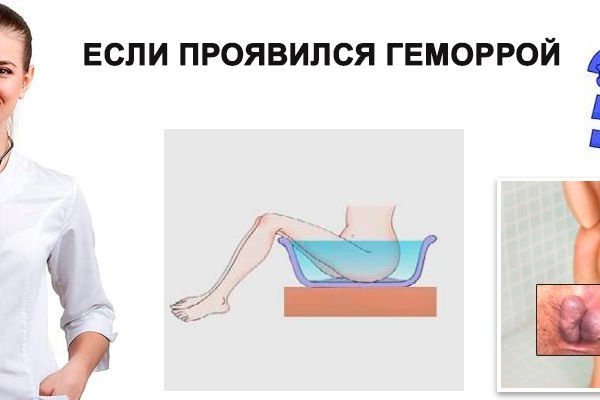 Кракен какой сайт